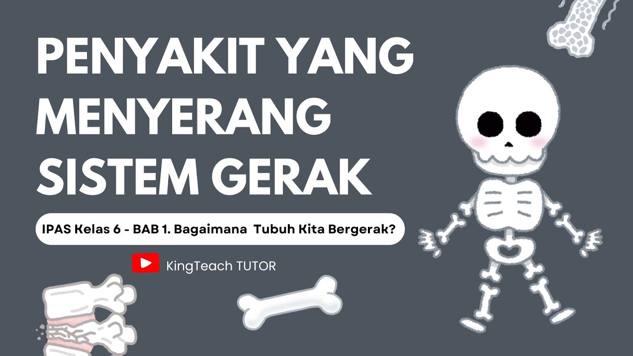 Kelas 6 SD KURMER - IPAS BAB 1. Bagaimana Tubuh Kita Bergerak? Materi: Kelainan Sistem Gerak Manusia
