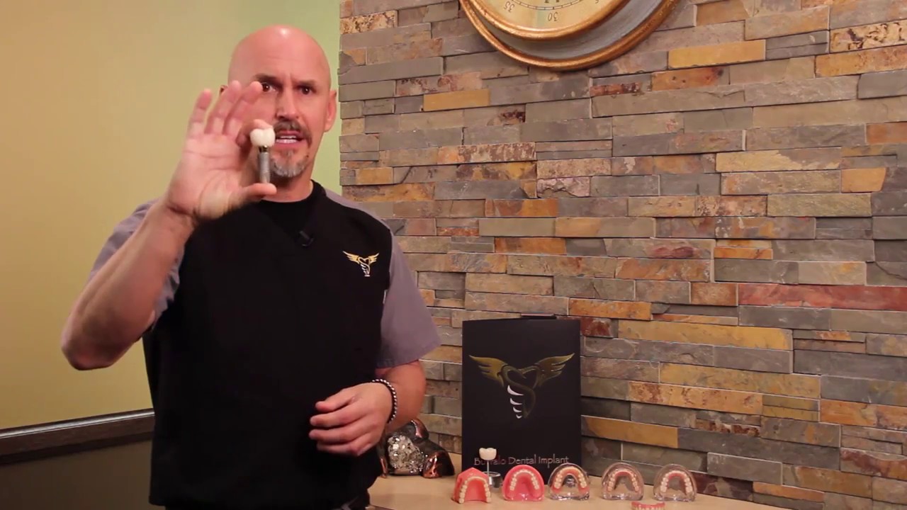 Buffalo Dental Implant answers 