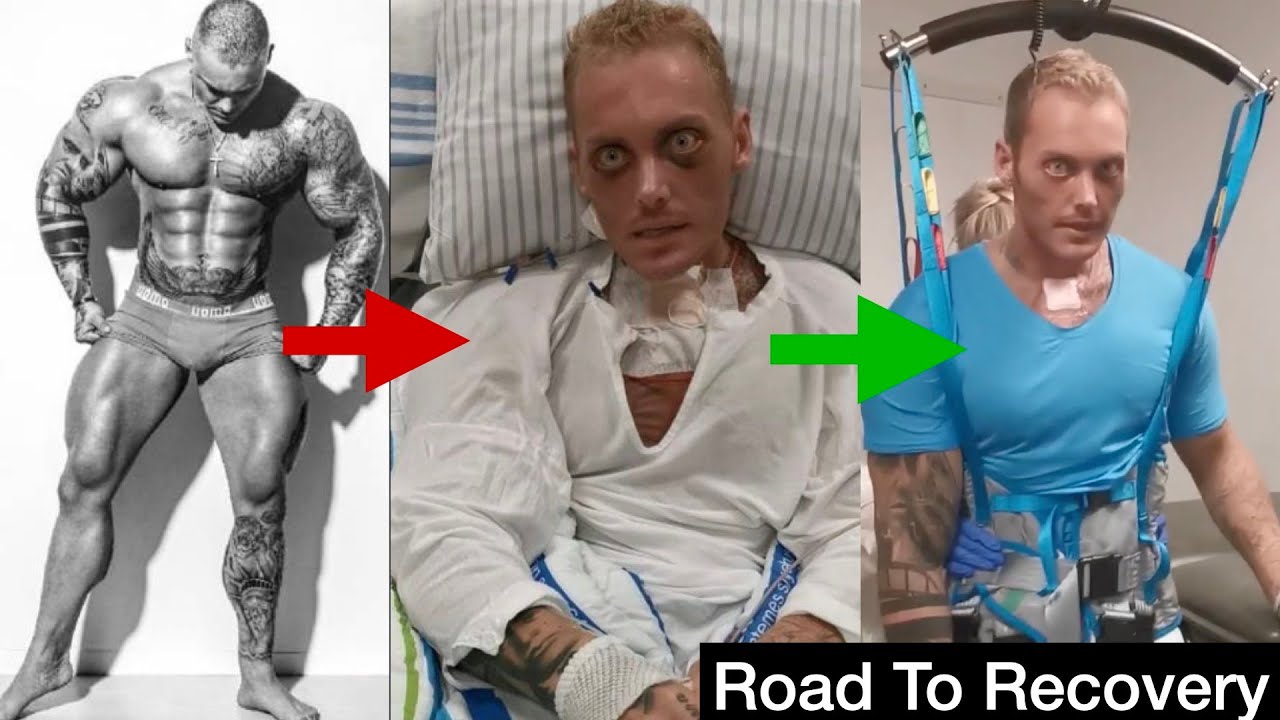 Патрик Тейхерт | Этот бодибилдер ВЕРНУЛСЯ из мёртвых