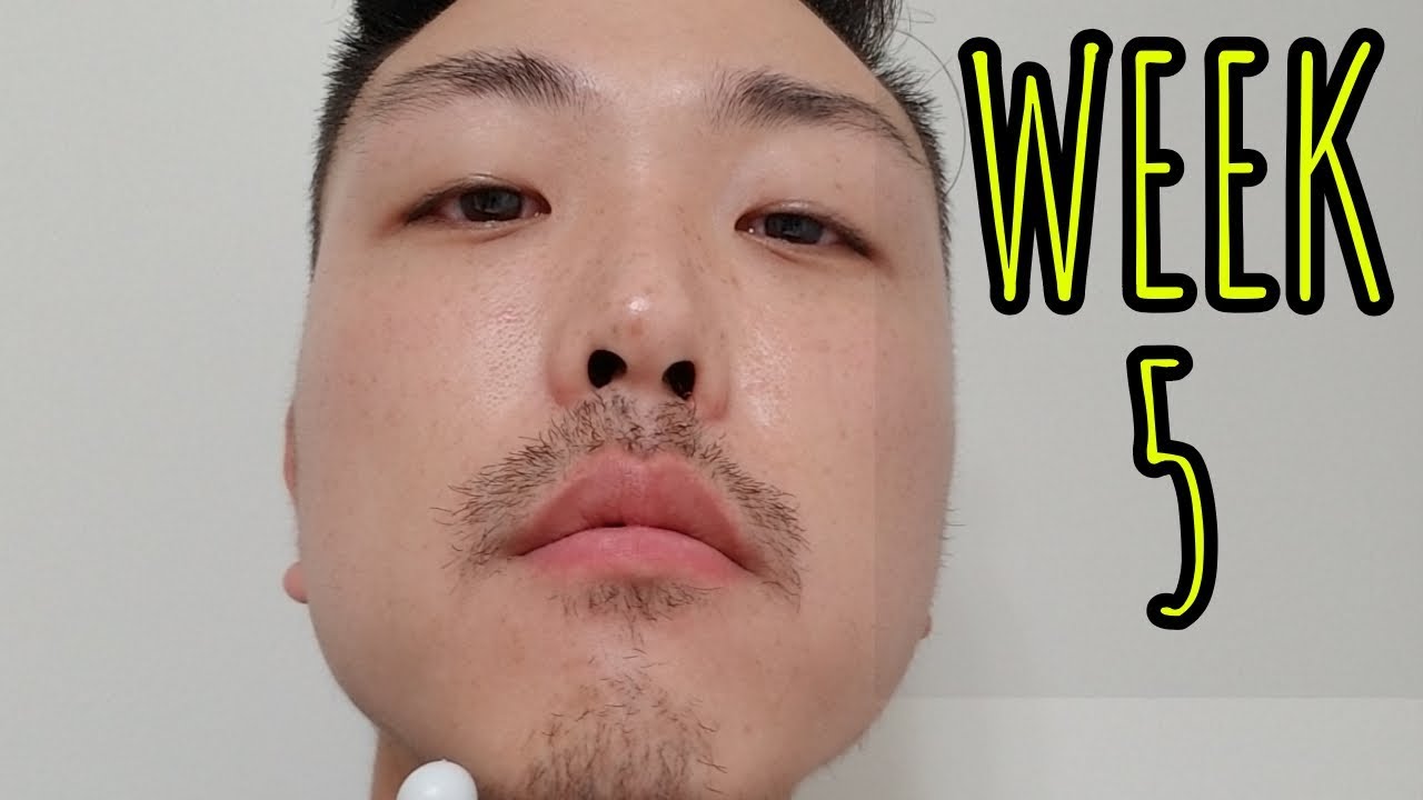 WEEK 5 MINOXIDIL BEARD GROWTH!