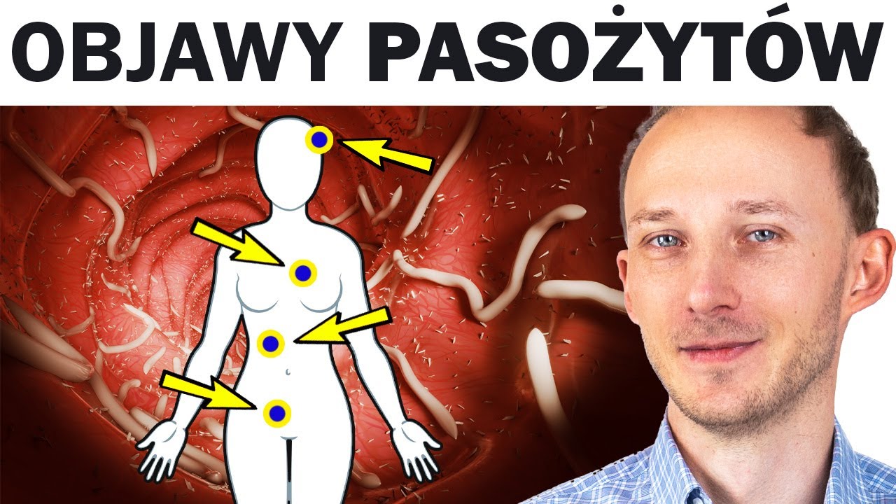 Takie są objawy pasożytów w ciele. Nie ignoruj ich