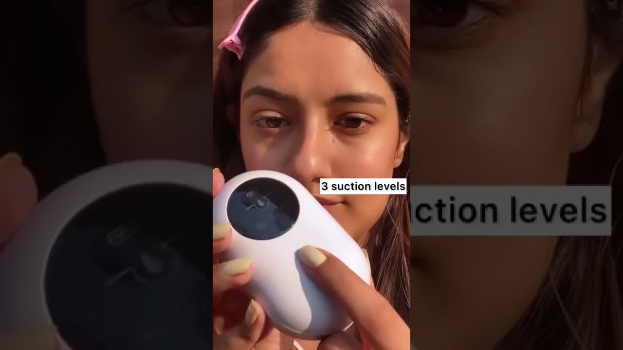 Get rid of Blackheads | Whiteheads With WINSTON Blackhead Remover