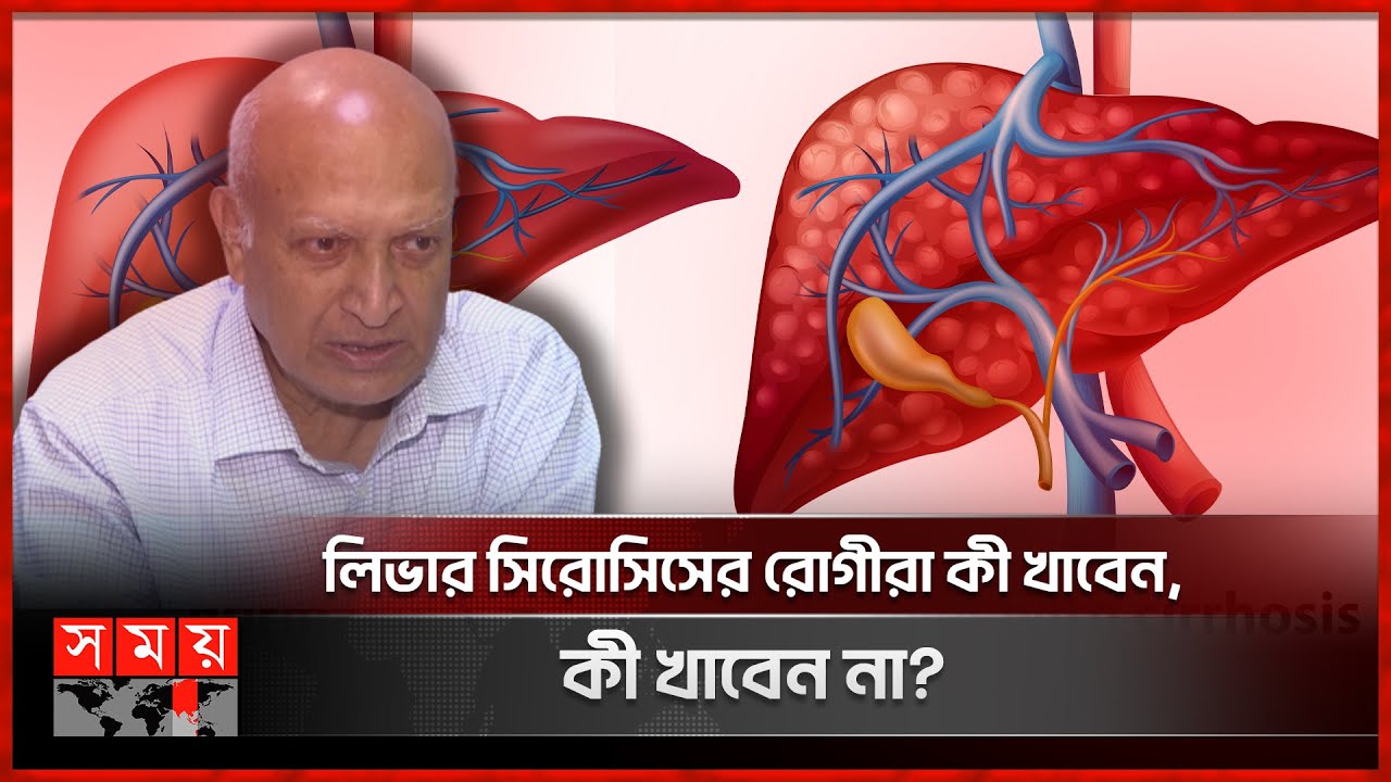 রোজায় সুস্থতা: লিভার সিরোসিস প্রতিরোধে ডাক্তারের পরামর্শ | Liver Cirrhosis | Liver Disease |Somoy TV