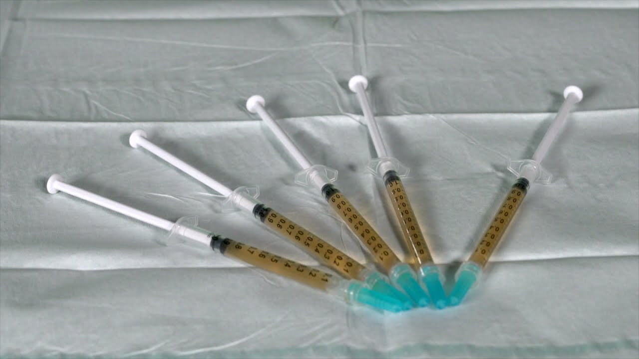How to Properly Prepare Syringes of PRP to PRFM