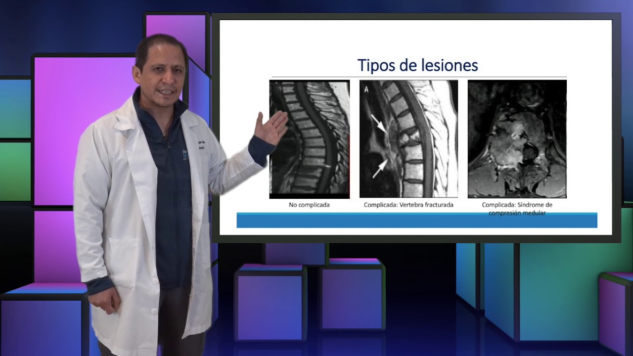 Manejo de Metastasis en Columna Vertebral en el INCan, 2021