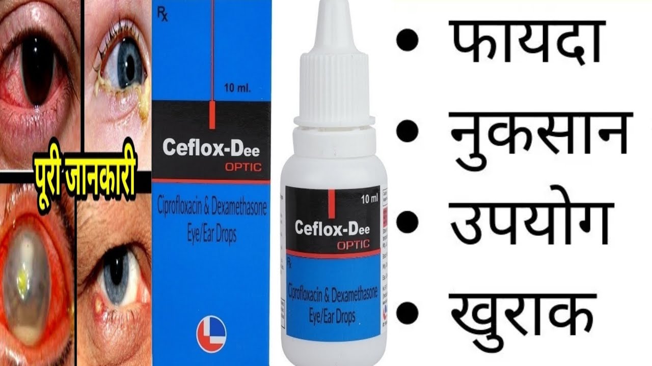 ceflox dee eye ear drops || उपयोग आणि दुष्परिणाम || ciplox d eye ear drops || #medicine #pharmacy