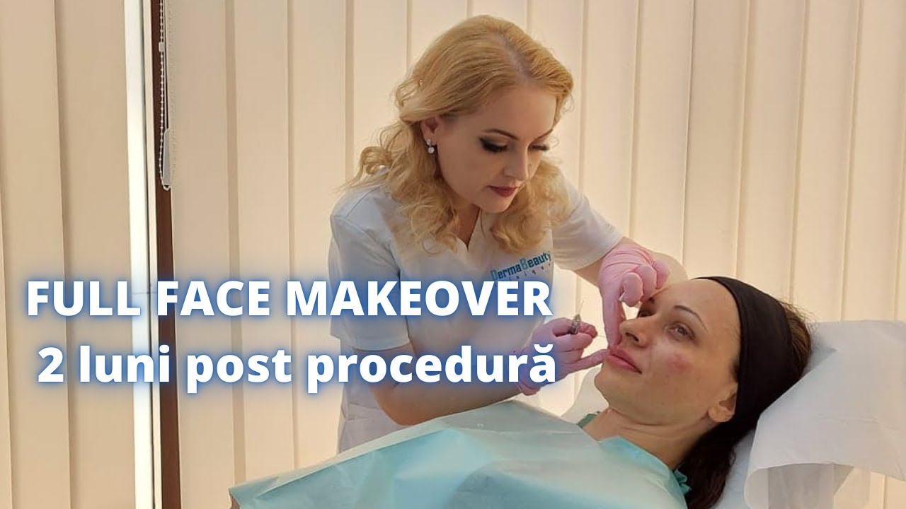 Testimonial - Full Face Makeover (2 luni post procedura) | DermaBeauty Clinique