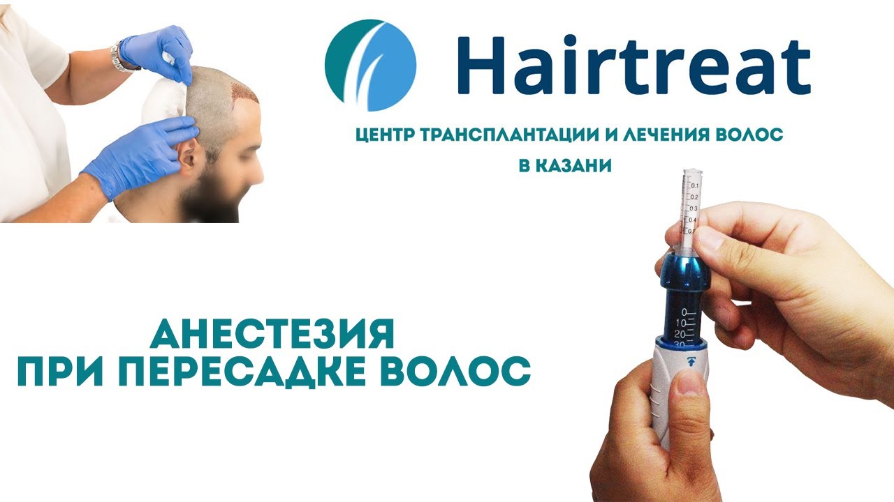 Обезболивание (анестезия) при пересадке волос