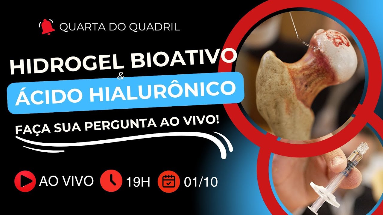 Tudo sobre HIDROGEL BIOATIVO e ÁCIDO HIALURÔNICO  - Quarta do Quadril nº179