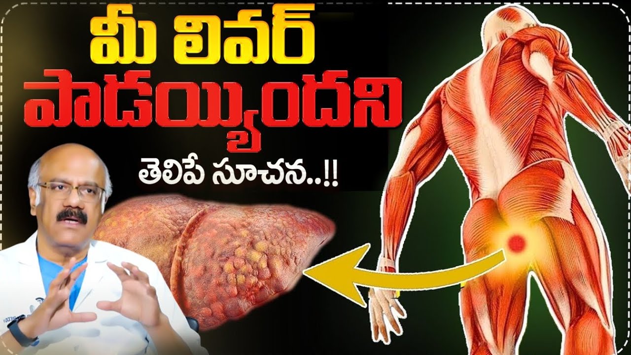 మీ లివర్ పాడయ్యిందని తెలిపే సూచన..| Liver Damage Signs | Dr Nageswara Reddy | Anchor Swapna