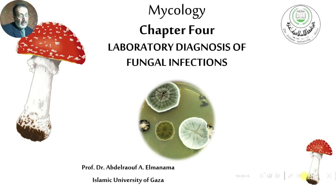 lab diagnosis of fungal infection