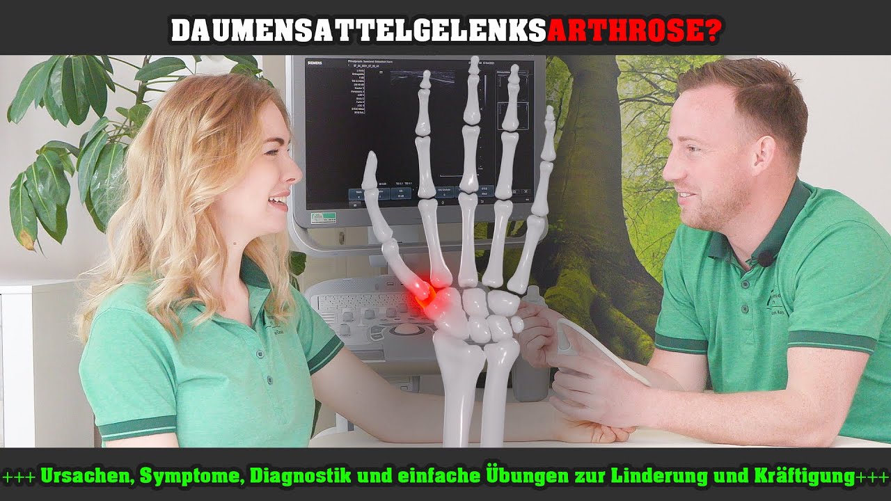Die Daumensattelgelenksarthrose!