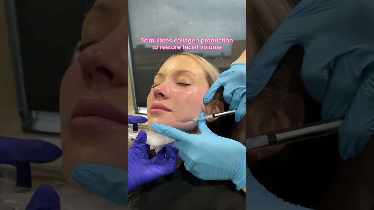 What is Sculptra?