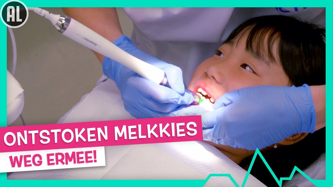 ONTSTOKEN MELKKIES TREKKEN 🦷 - TOPDOKS