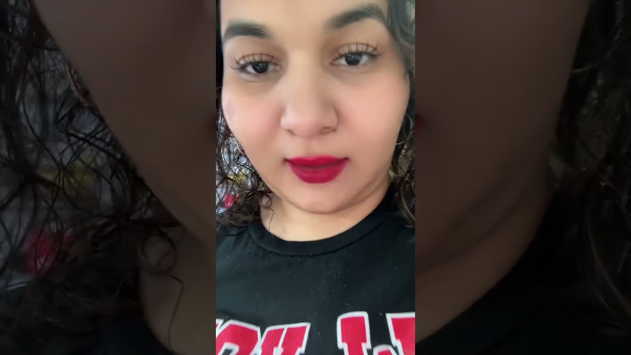 Primera semana pos cirugía bariatica Baypass Gástrico #bypass #cirugíabariátrica #bariatricsurgery 