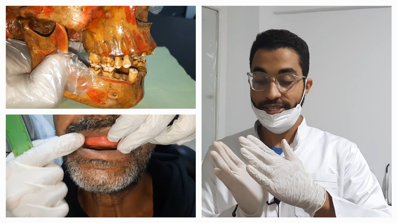 jaw relation (bite) registration for complete denture practical (عربي)