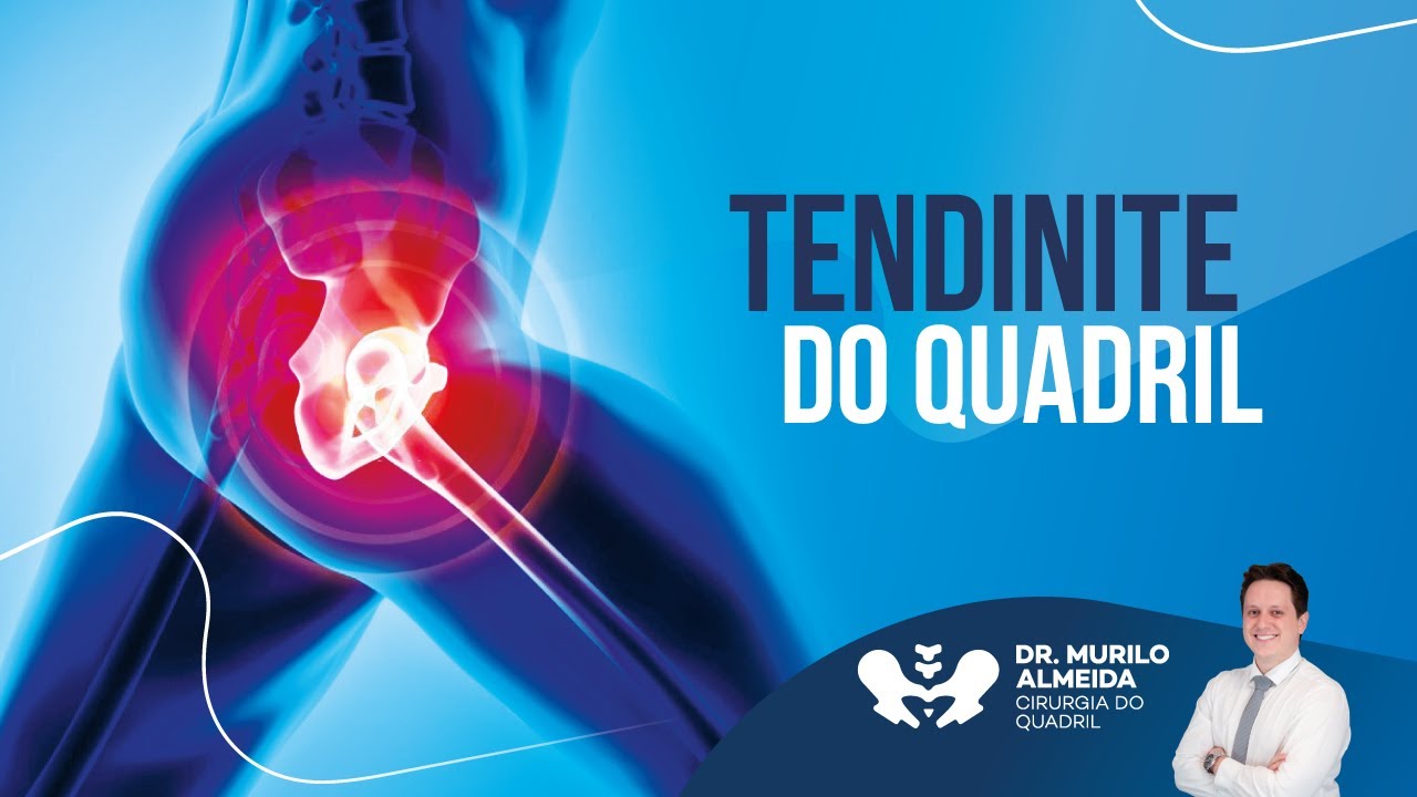 Por que minha tendinite n&atilde;o melhora? | Dr. Murilo Almeida