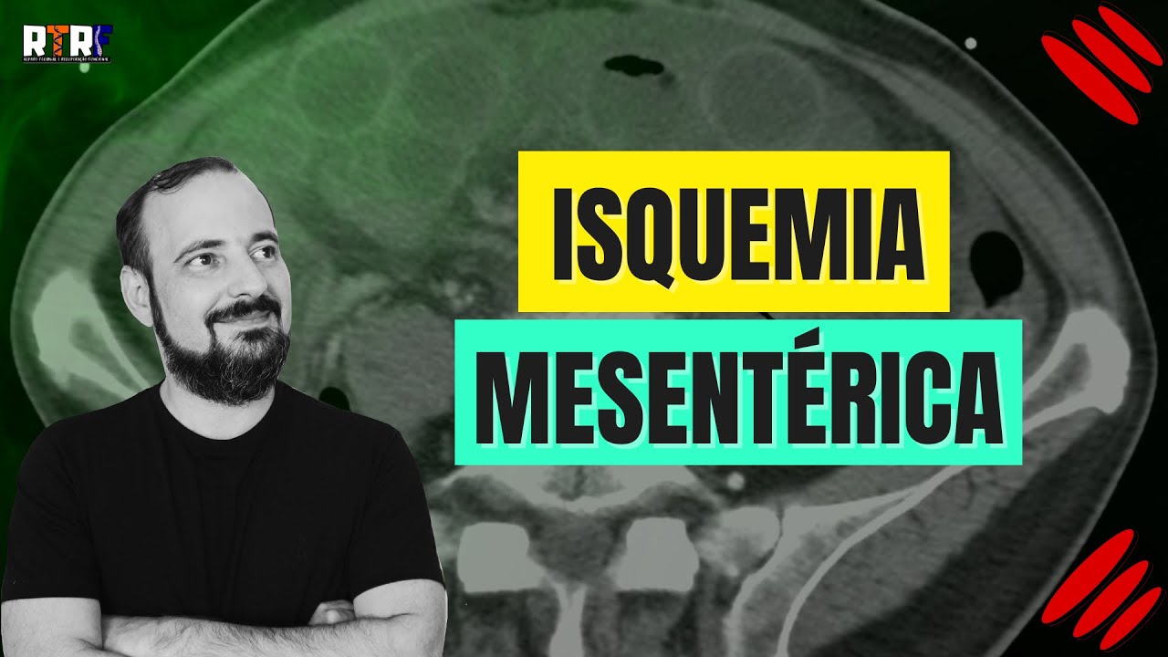 Isquemia mesentérica | José Góes