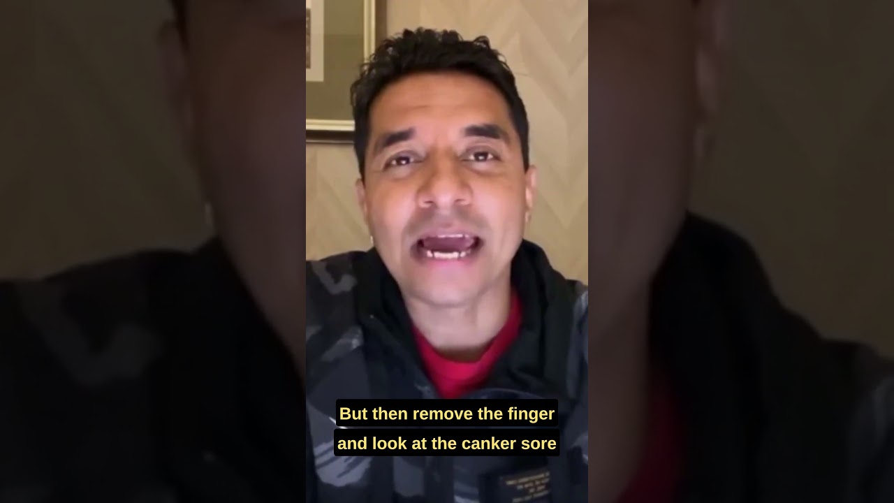 A Simple Inexpensive & Effective Remedy For Canker Sores