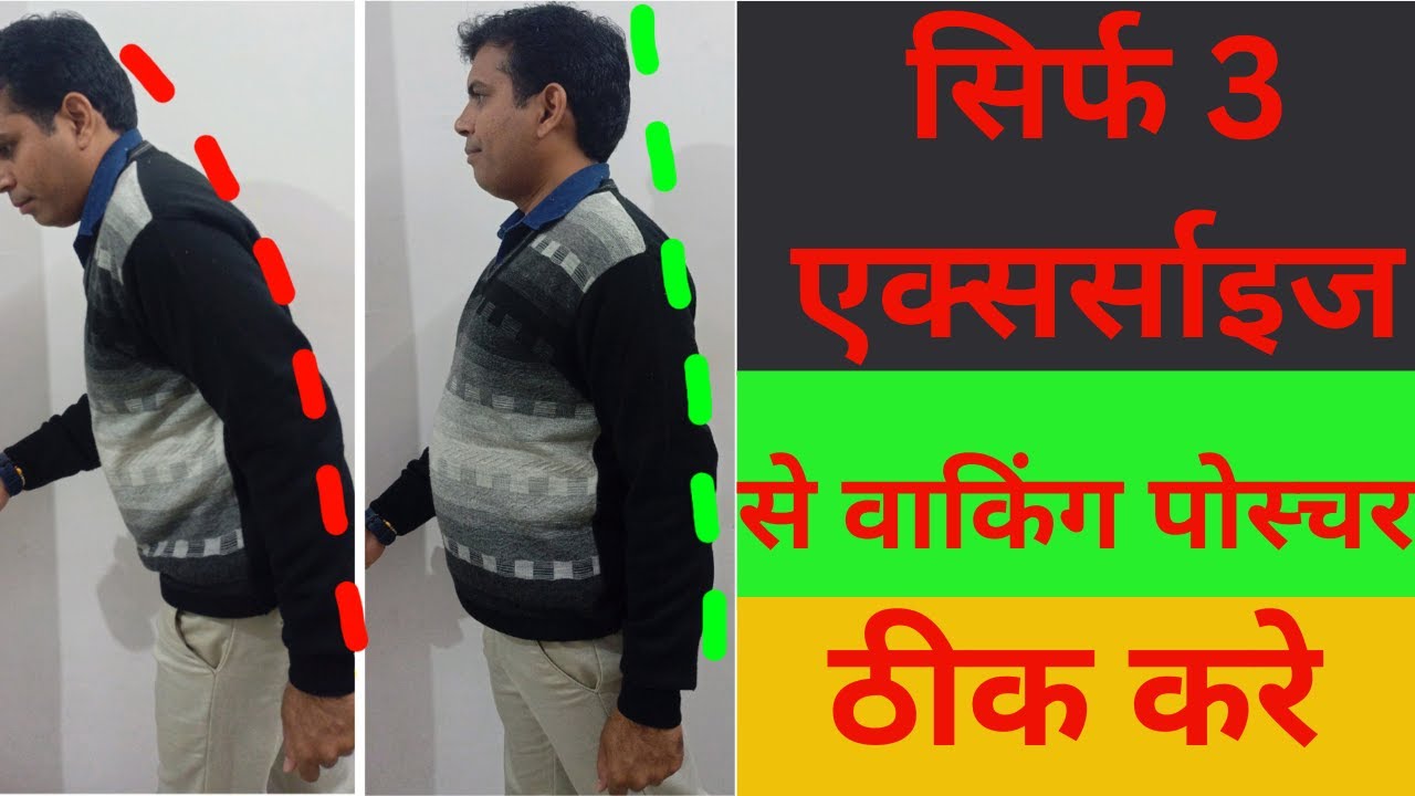 WALKING POSTURE CORRECTION EXERCISE। सिर्फ 3 एक्सरसाइज से वॉकिंग पोस्चर ठीक करे। 
