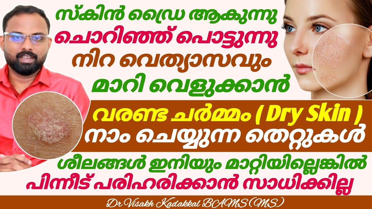 ഡ്രൈ സ്കിൻ എളുപ്പത്തില് മാറ്റാം | ചൊറിച്ചിലും കറുപ്പ് നിറവു മാറി സ്കിൻ വെളുക്കാൻ ഇങ്ങനെ ചെയ്യുക