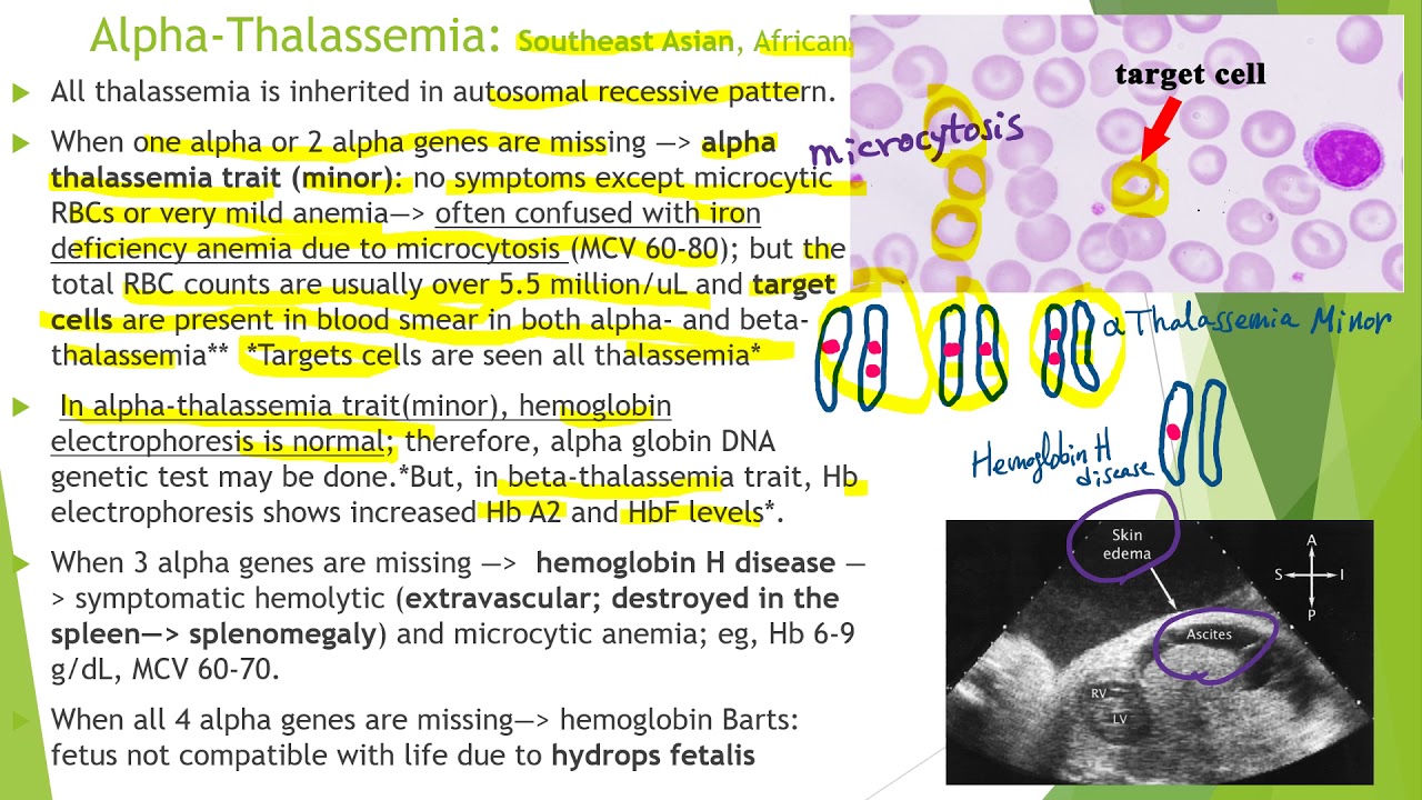 Hematology in 10 min:  Hemoglobinopathy &Thalassemia
