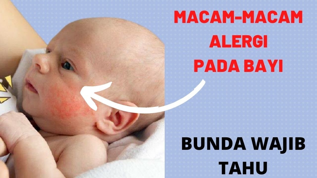 Macam-Macam Alergi Kulit pada Bayi dan Penyebabnya