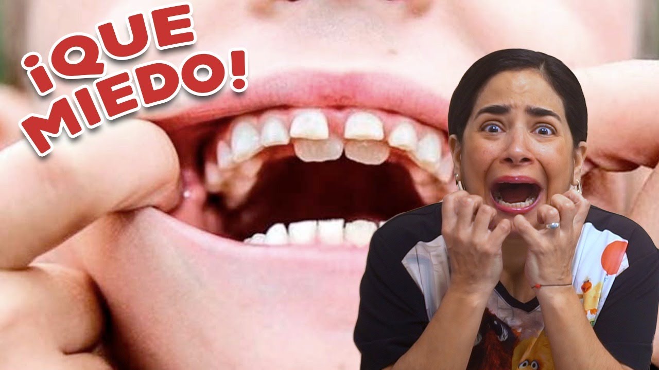 ¿Por qué NO se le Caen los Dientes a mi Hijo? ¿QUÉ HACER?