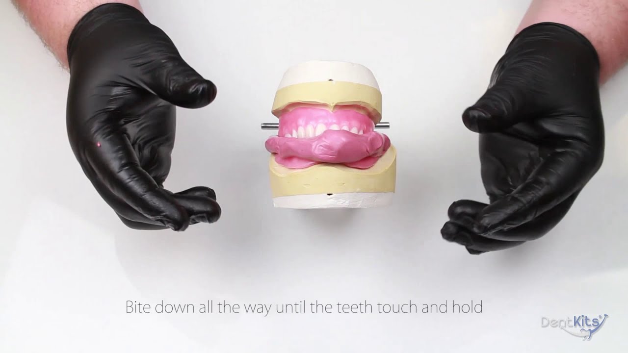 Wax Try-in RESET Guide for your Denture DentKits Order