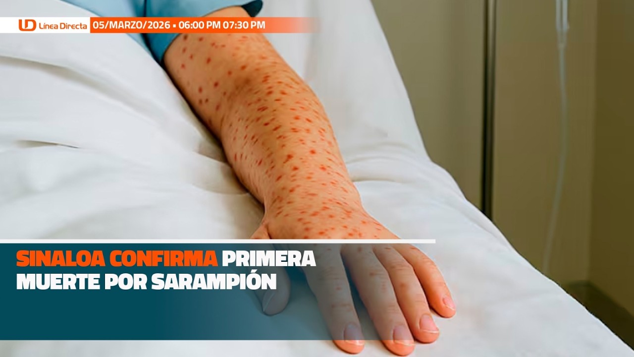 Sinaloa confirma primera muerte por sarampión