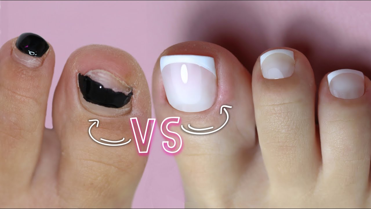 FRENCH PEDICURE - comment réparer 𝟙 ongle cassé ou fissuré  🤓