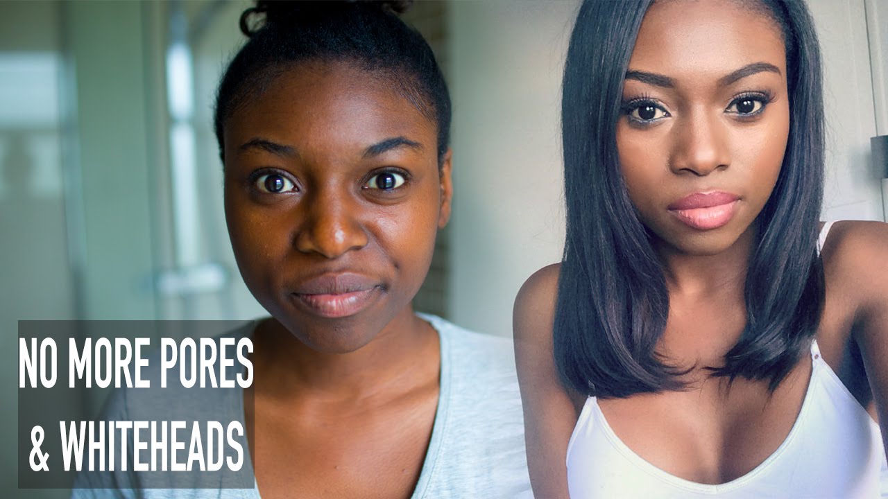 HOW I CLEARED MY SKIN & GOT RID OF LARGE PORES WHITEHEADS & ROUGH TEXTURE
