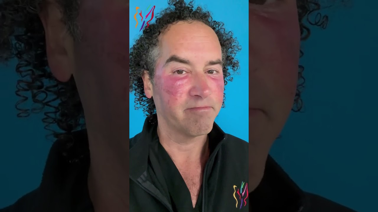 Doctor Becomes the Patient  Dr  Jon Mendelsohn's Day-by-Day Recovery with DOT Laser Treatment.