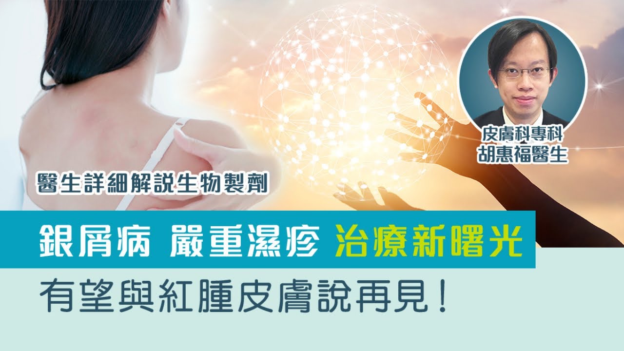 嚴重濕疹/銀屑病(牛皮癬)治療 | 生物製劑治療免疫系統疾病有效持久！皮膚科醫生講解生物製劑原理、成效、副作用及價錢