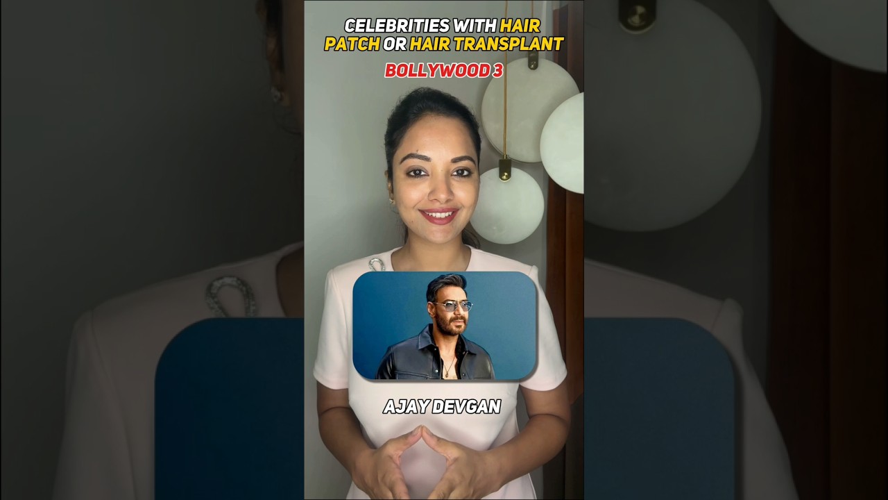 Hair Patch or Transplant? Here's what Celebs chose ? PART 3 🤯