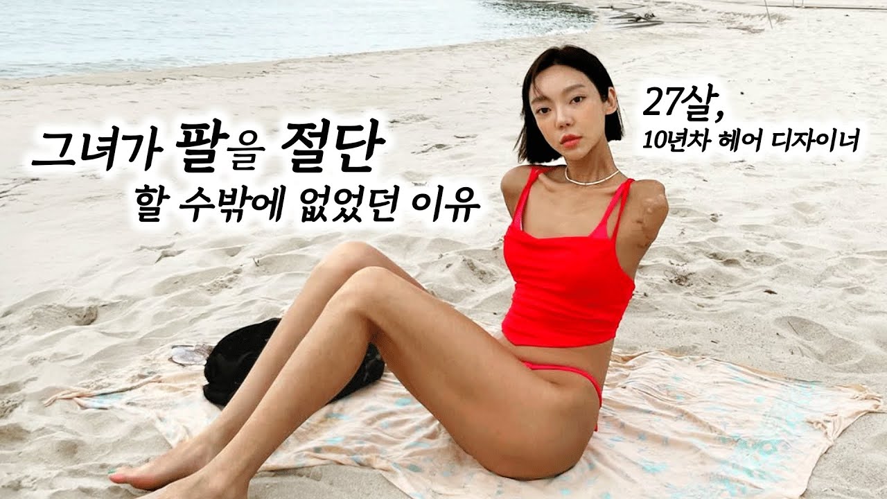 한순간에 팔을 잃은 헤어디자이너가 세상을 사는 방법