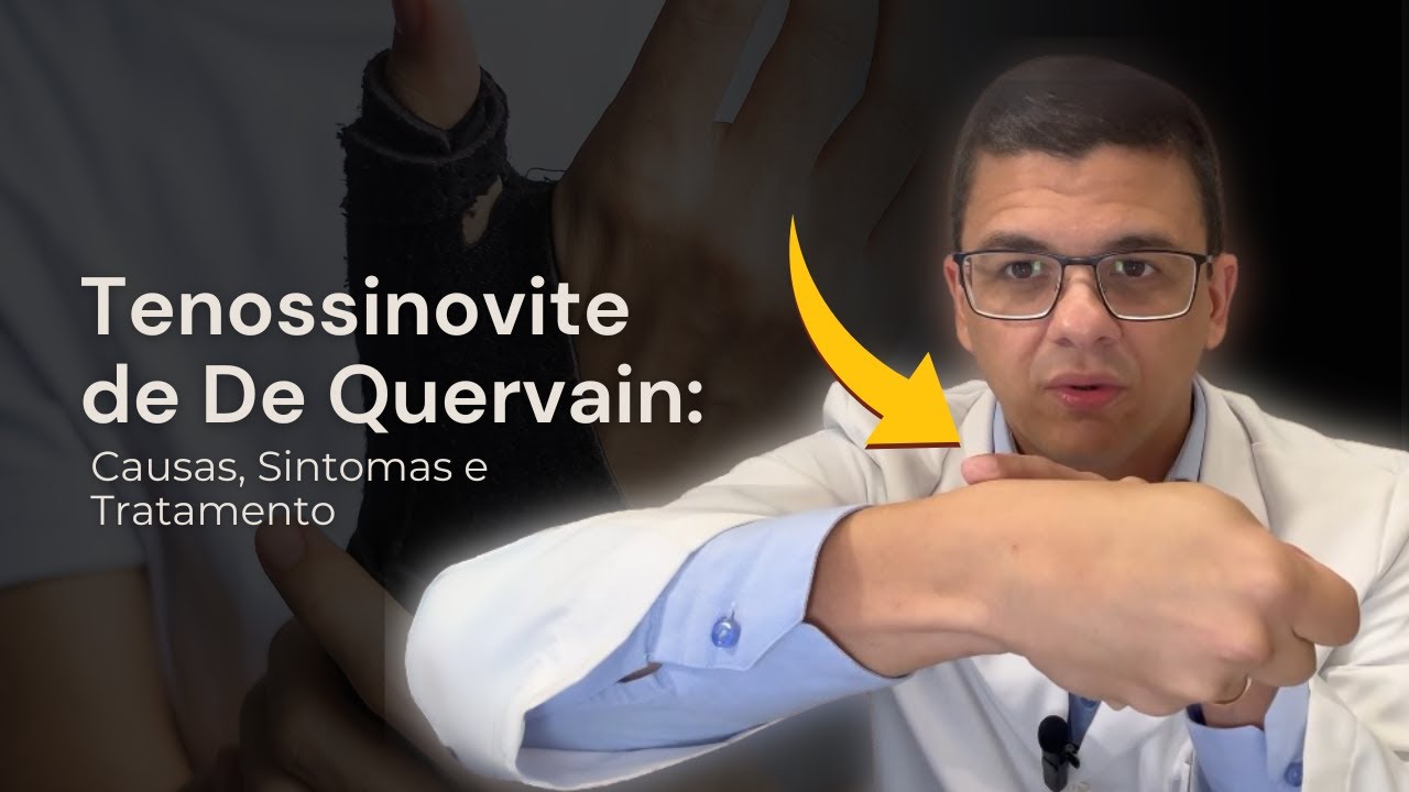 Tenossinovite de De Quervain - Causas, Sintomas e Tratamento l Dr. Ronaldo Novais - Cirurgia da Mão