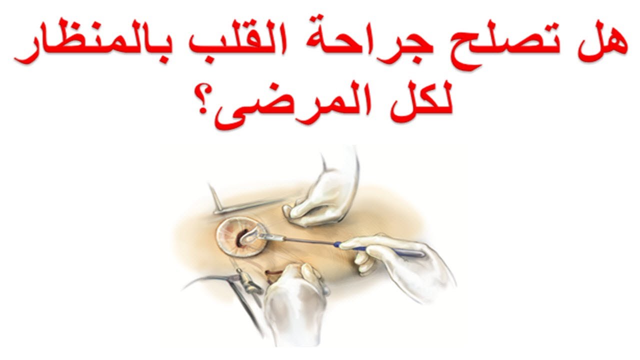 جراحة القلب بالمنظار هل تصلح لكل المرضى؟ موانع اجراء القلب المفتوح بالتدخل المحدود بدون شق الصدر