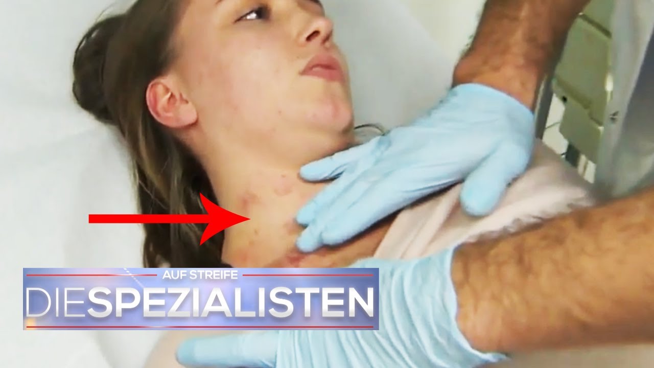 Normal ist das nicht! Nur ein Ausschlag? | Die Spezialisten | SAT.1