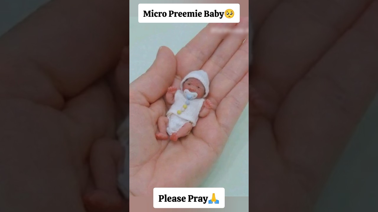 Micro Preemie baby🥺 Please Pray🙏#baby #preemiebaby #premature #shortvideo #shorts #viralvideo #viral