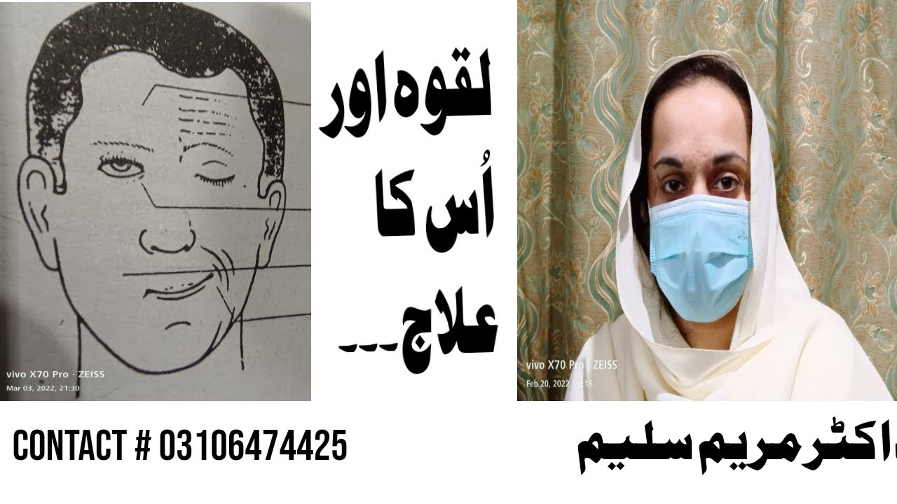 Bell's palsy treatment | laqwa ka elaj | Roshan Health