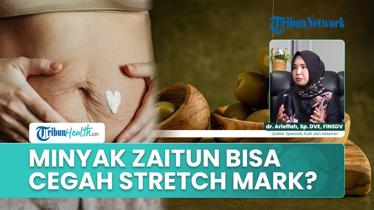 Benarkah Minyak Zaitun Ampuh Mencegah Stretch Mark? Ini Penjelasan Medis yang Jarang Diketahui