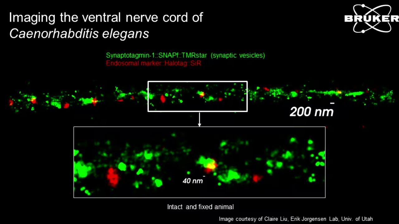 Super Resolution Microscopy | Unlocking 3D Nanostructure in Neurons | Neuroscience 2019 | Bruker