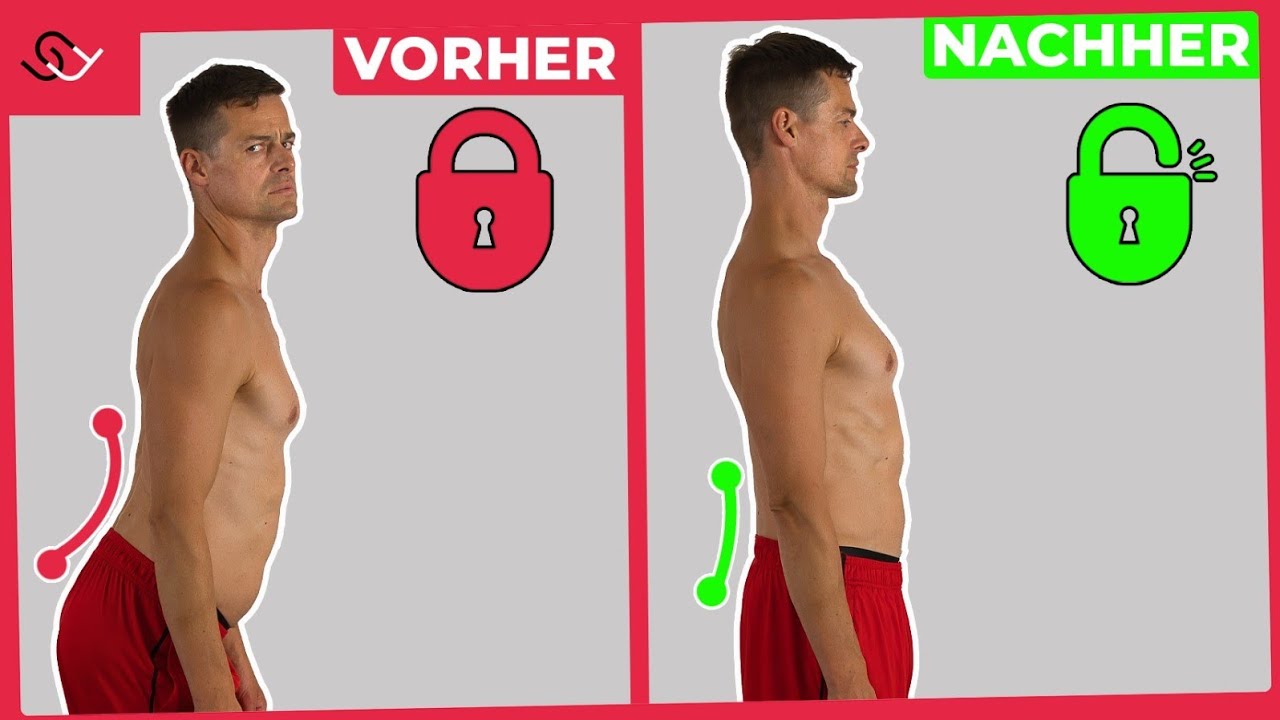 Hohlkreuz verstehen und sofort loswerden!