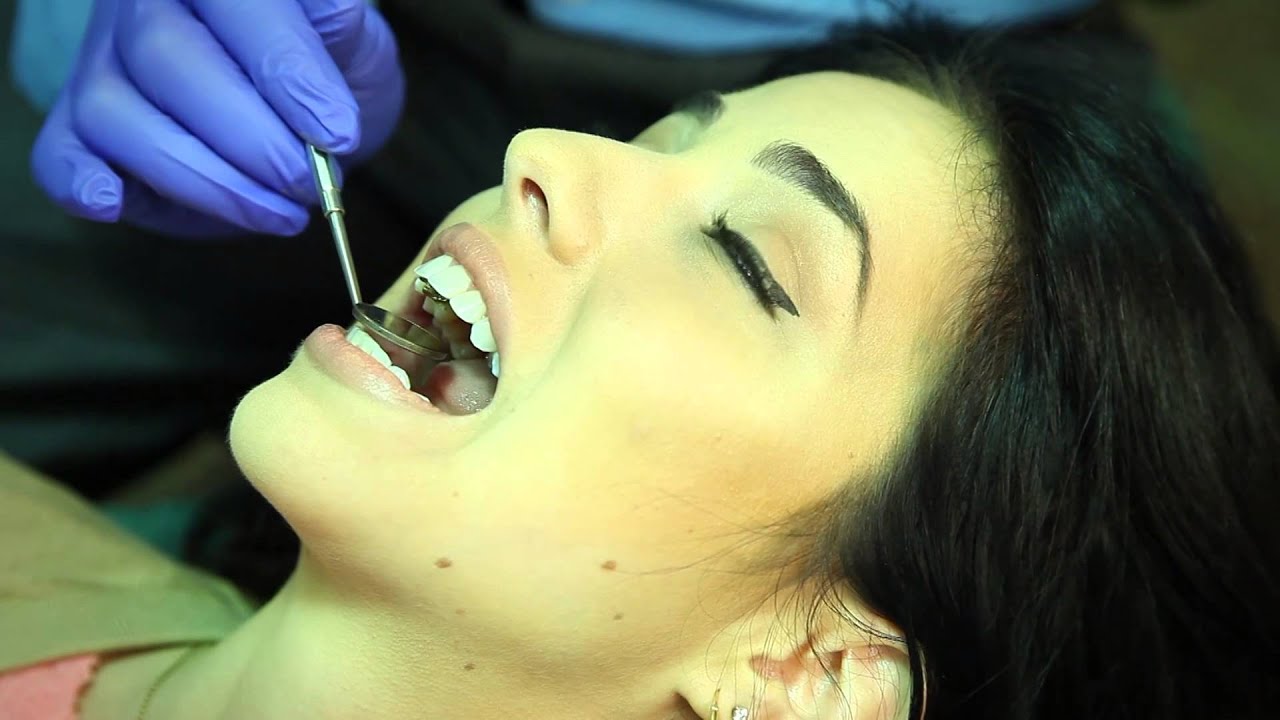 Incognito Lingual Braces | Orthodontist Pensacola FL