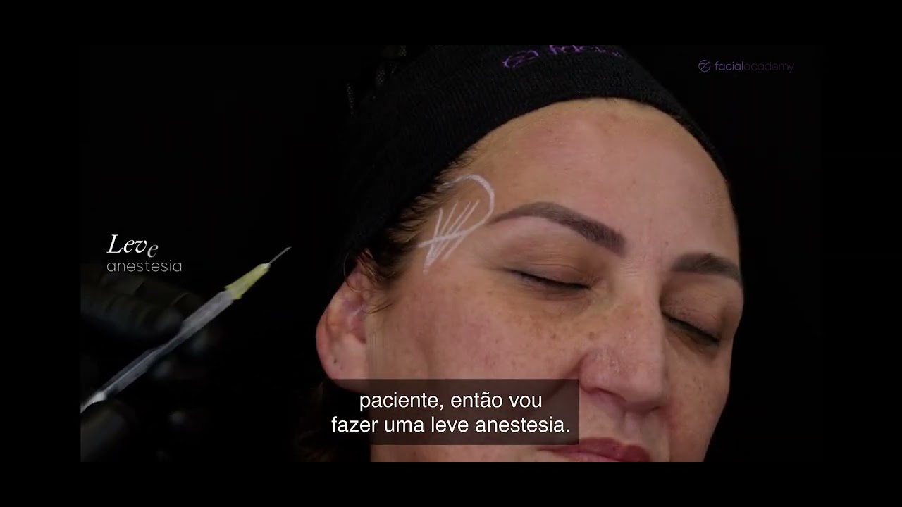 Preenchimento de têmpora