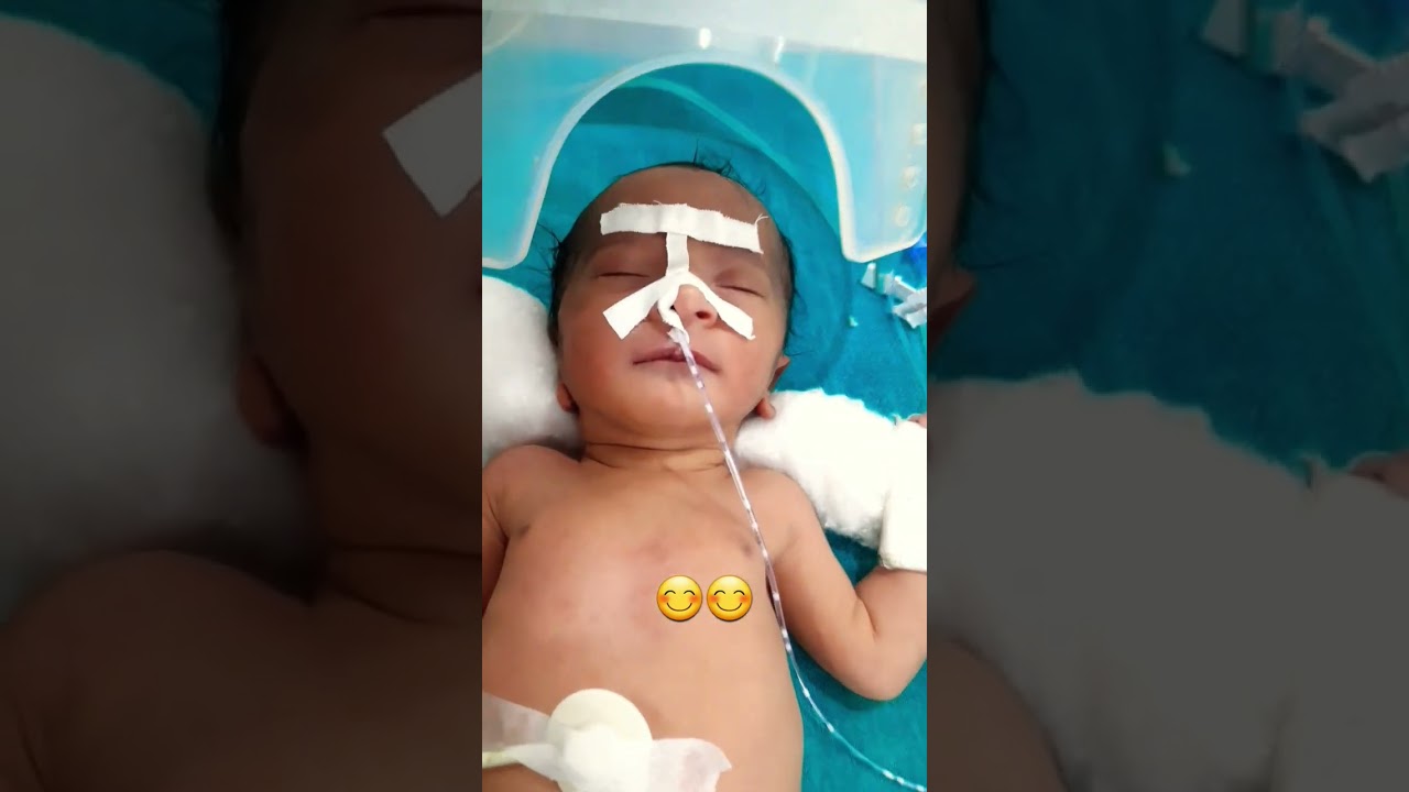 icu baby care #youtubeshorts #newbornbaby #icu #baby #baby #babydocter  ❤❤