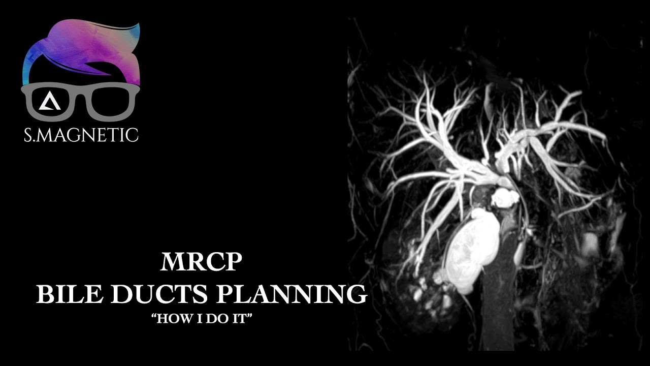MRCP BILE DUCTS PLANNING. 