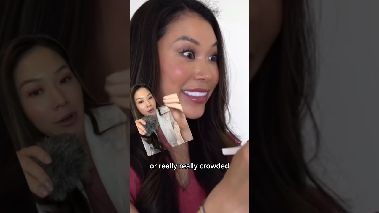 Pop on veneers review. 
