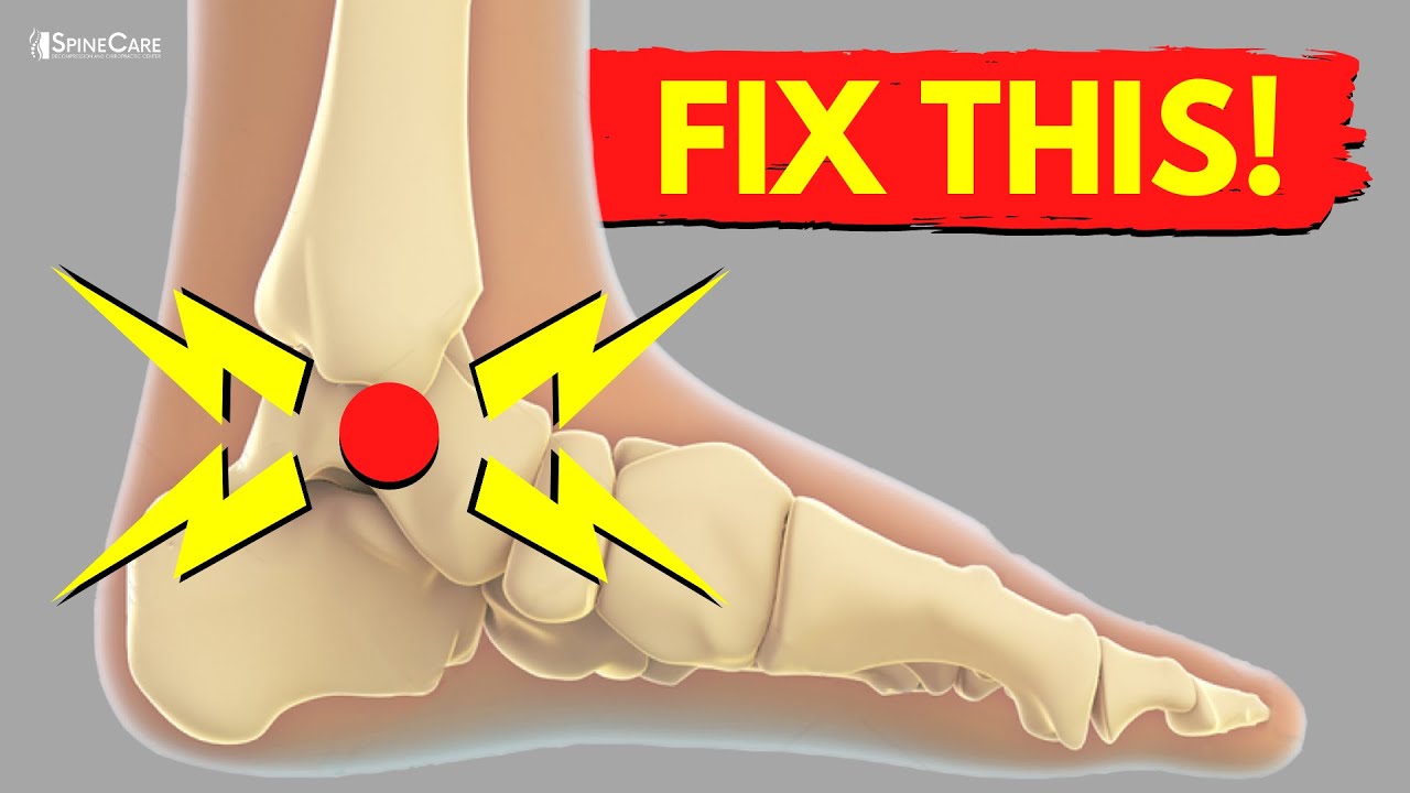 How to Fix Ankle CRACKING and POPPING Sounds